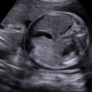 DC-40 - Primary Care Ultrasound Systems
