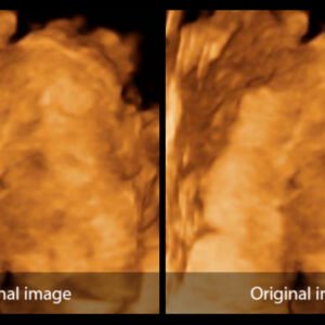 DC-40 - Primary Care Ultrasound Systems