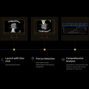 United Imaging uCT Calcium Scoring