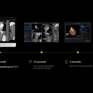United Imaging uCT Heart