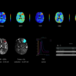 United Imaging uCT Brain Perfusion