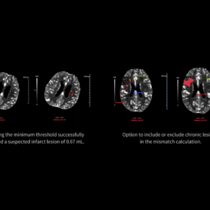 United Imaging uCT Brain Perfusion
