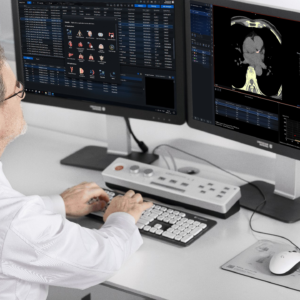 United Imaging uCT Calcium Scoring