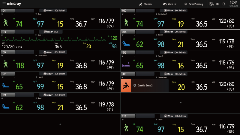 mWear Wearable Patient Monitor 12 mWear Wearable Patient Monitor - Image 12