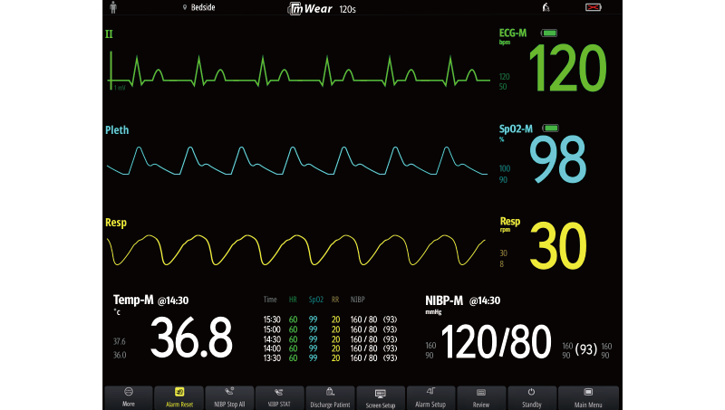 mWear Wearable Patient Monitor 16 mWear Wearable Patient Monitor - Image 16
