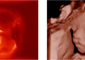 Z50 - Primary Care Ultrasound Systems