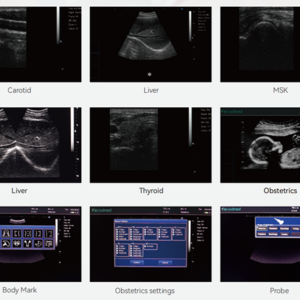 Yonker General Abdominal Health Assessment Black and White Ultrasound Machine