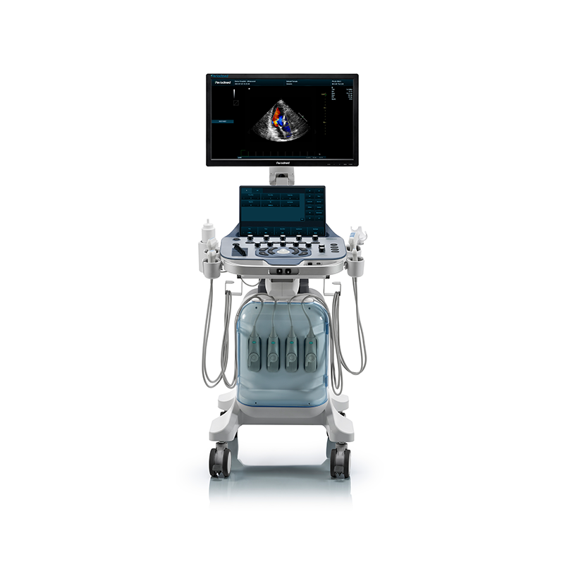 Yonker NEW Premium Diagnostic Ultrasound System Revo T2 2 Yonker NEW Premium Diagnostic Ultrasound System Revo T2 - Image 2