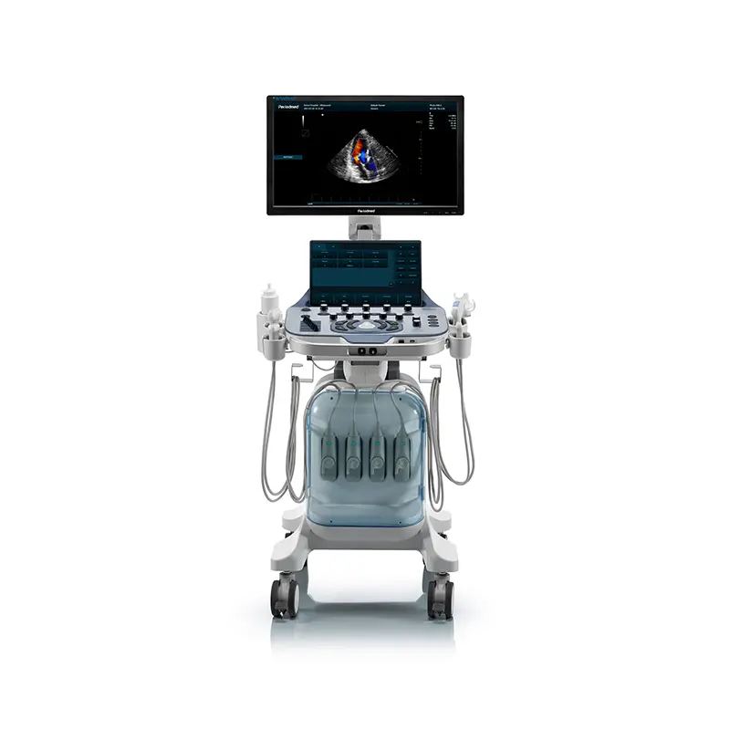 Yonker High-Resolution Veterinary Ultrasound Device for Kidney and Bladder Evaluation in Cats 2 Yonker High-Resolution Veterinary Ultrasound Device for Kidney and Bladder Evaluation in Cats - Image 2