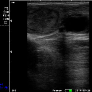 Yonker Veterinary Ultrasound Portable Color Doppler Ultrasound Machine PU-VP051A