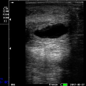 Yonker Veterinary Ultrasound Portable Color Doppler Ultrasound Machine PU-VP051A