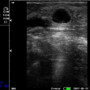 Yonker Veterinary Ultrasound Portable Color Doppler Ultrasound Machine PU-VP051A