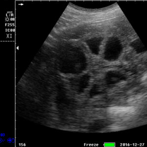 Yonker Veterinary Ultrasound Portable Color Doppler Ultrasound Machine PU-VP051A