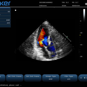 Yonker New Yonker Cheap Portable Color Doppler Ultrasound Machine PU-L151A