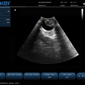 Yonker Veterinary Ultrasound Portable Color Doppler Ultrasound Machine PU-VP151A