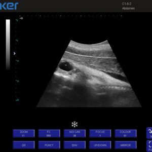 Yonker Veterinary Ultrasound Portable Color Doppler Ultrasound Machine PU-VP151A