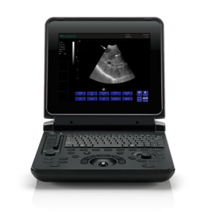 Yonker Black and white Digital Diagnostic Ultrasound System PU-DL121A