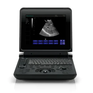 Yonker General Abdominal Health Assessment Black and White Ultrasound Machine