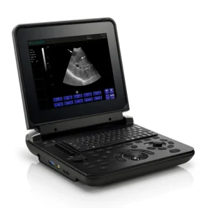 Yonker General Abdominal Health Assessment Black and White Ultrasound Machine