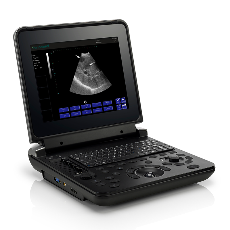Yonker Black and white Digital Diagnostic Ultrasound System PU-DL121A 2 Yonker Black and white Digital Diagnostic Ultrasound System PU-DL121A - Image 2