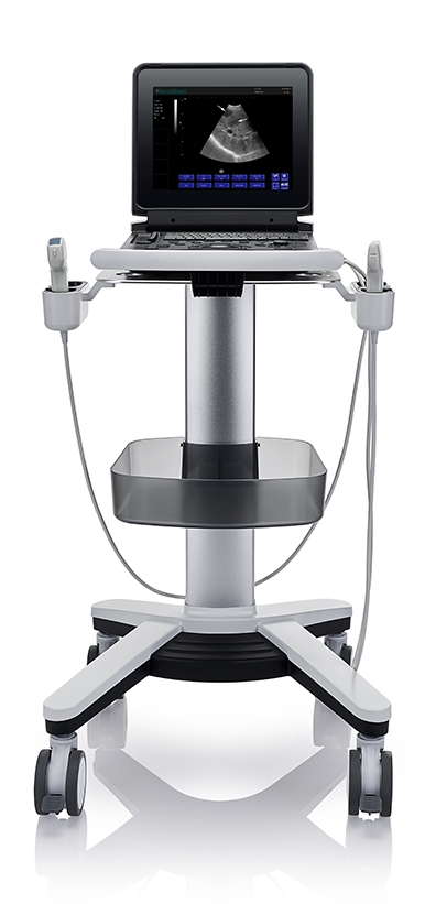 Yonker Black and white Digital Diagnostic Ultrasound System PU-DL121A 3 Yonker Black and white Digital Diagnostic Ultrasound System PU-DL121A - Image 3