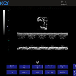 Yonker Veterinary Ultrasound Portable Color Doppler Ultrasound Machine PU-VP151A