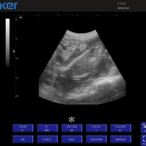 Yonker Veterinary Ultrasound Portable Color Doppler Ultrasound Machine PU-VP151A