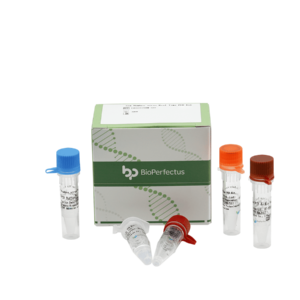 Sin Nombre Virus Real Time PCR Kit