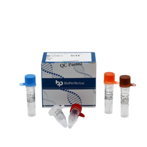 Toscana Virus Real Time PCR Kit