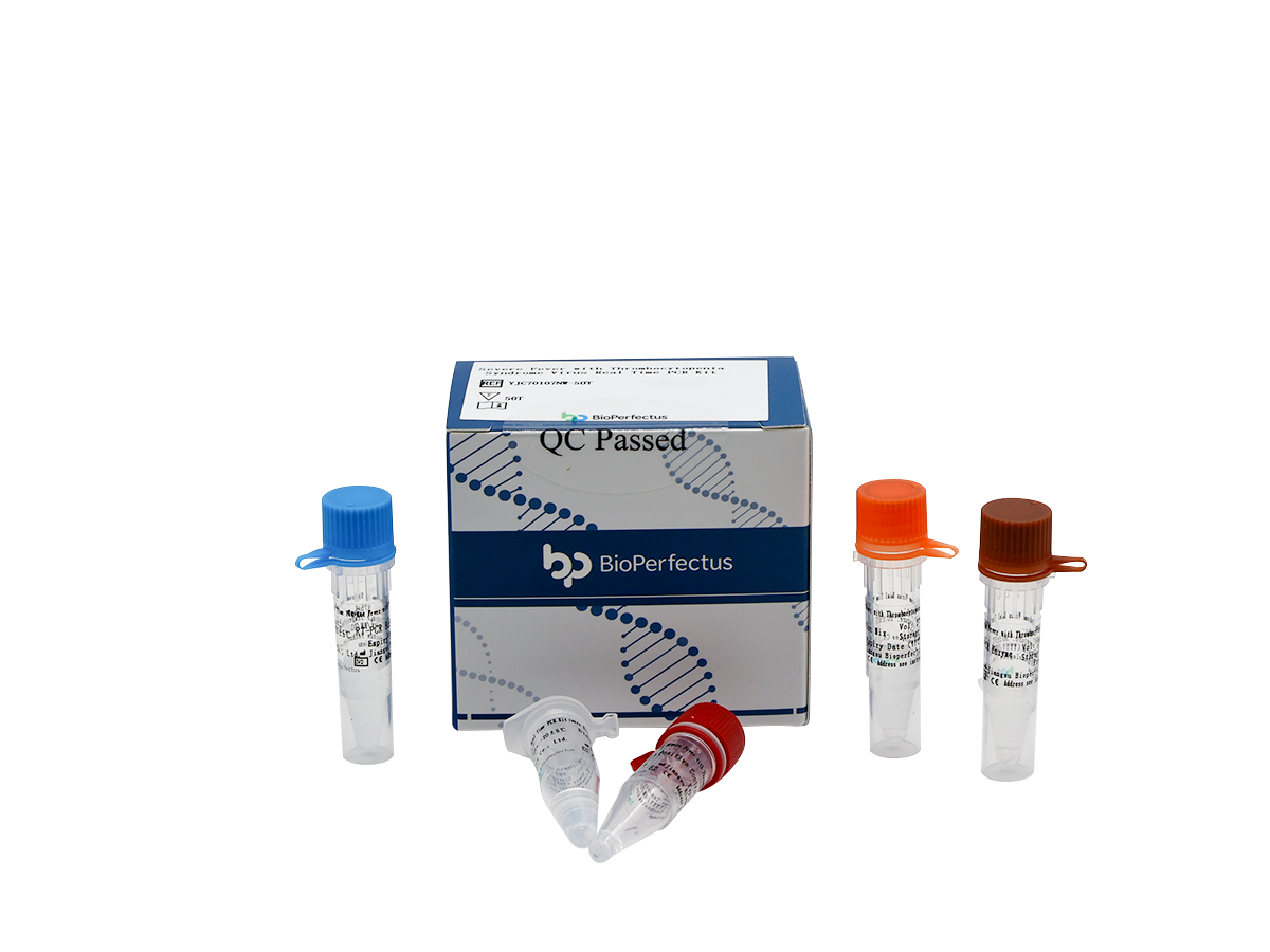 Severe Fever with Thrombocytopenia Syndrome Virus Real Time PCR Kit 1 Severe Fever with Thrombocytopenia Syndrome Virus Real Time PCR Kit