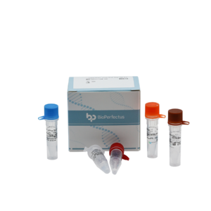 Hantavirus Real Time PCR Kit