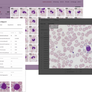 Aimagine Care FFscope F650 Fully Automated Hematology Cell Morphology Analyzer