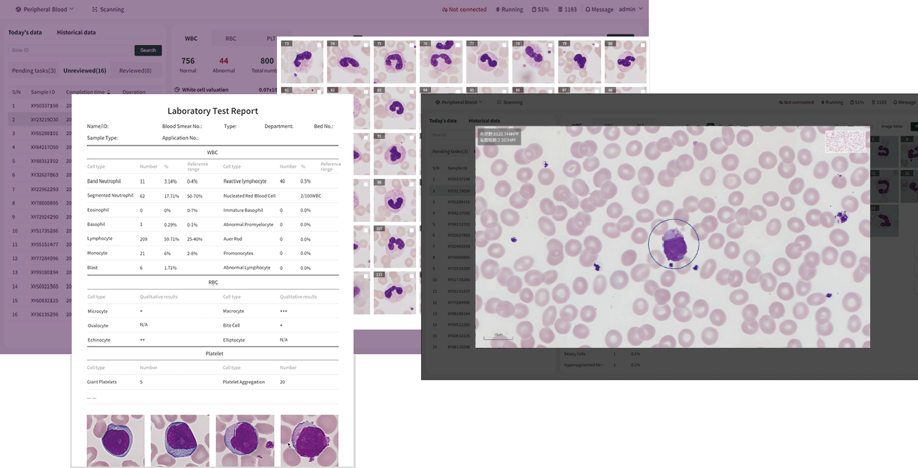 Aimagine Care FFscope F650 Fully Automated Hematology Cell Morphology Analyzer 3 Aimagine Care FFscope F650 Fully Automated Hematology Cell Morphology Analyzer - Image 3