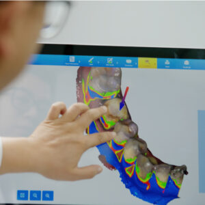 Launca DL-206 Intraoral Scanner