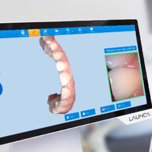 Launca DL-206 Intraoral Scanner