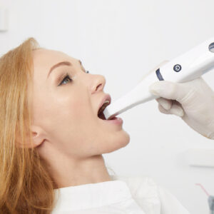 Launca DL-206P Intraoral Scanner