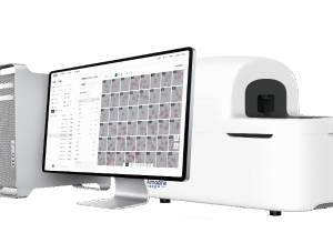 Aimagine Care FFscope M50 Fully Automated Malaria Parasite Analyzer