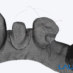 Launca DL-206P Intraoral Scanner