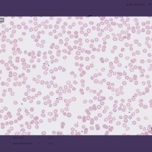 Aimagine Care FFscope F650 Fully Automated Hematology Cell Morphology Analyzer