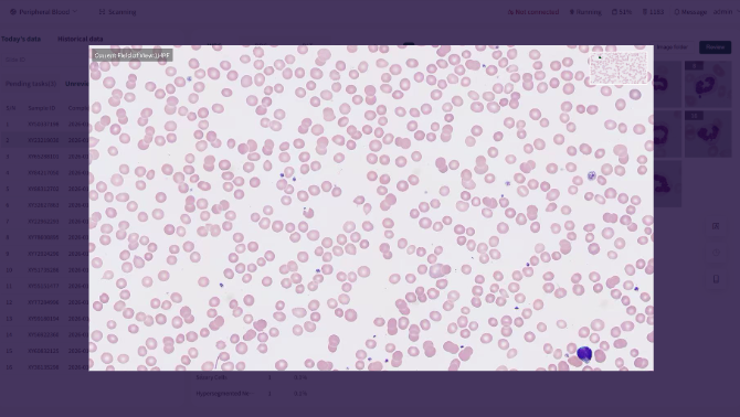 Aimagine Care FFscope F650 Fully Automated Hematology Cell Morphology Analyzer 4 Aimagine Care FFscope F650 Fully Automated Hematology Cell Morphology Analyzer - Image 4