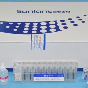 Sunlant Cardiopulmonary Function Marker Reagent Kit (Second Generation)